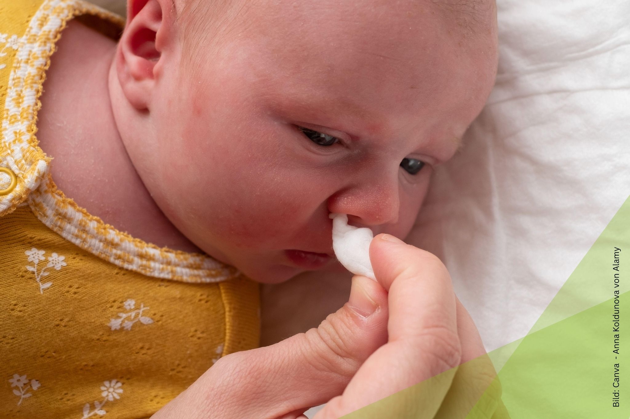 Baby mit Erkältung wird die Nase geputzt zum Thema Erkältung beim Baby: Homöopathie bei Schnupfen, Husten und Unruhe